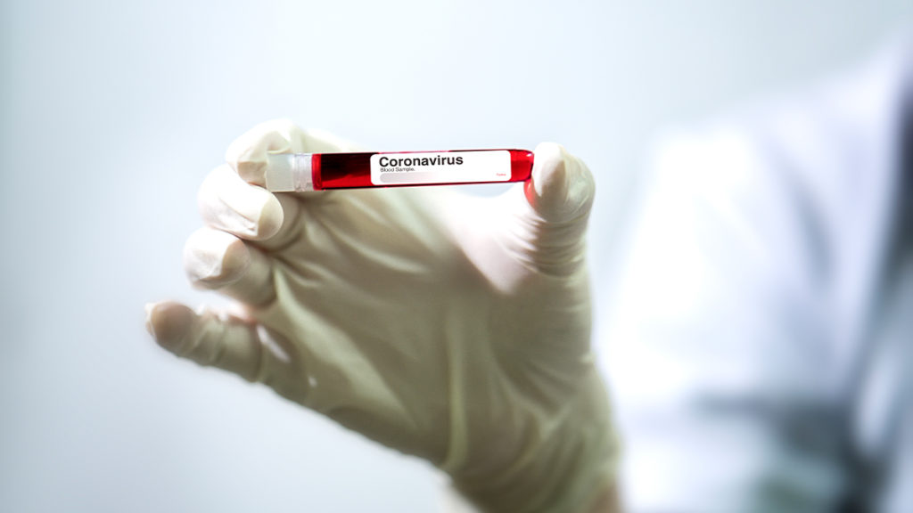 CoronaVirus Origin Deaths Vision Plus Truth and Lies