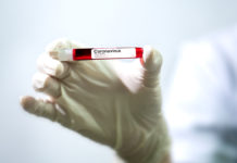 CoronaVirus Origin Deaths Vision Plus Truth and Lies CoronaVirus Origin Deaths Vision Plus Truth and Lies